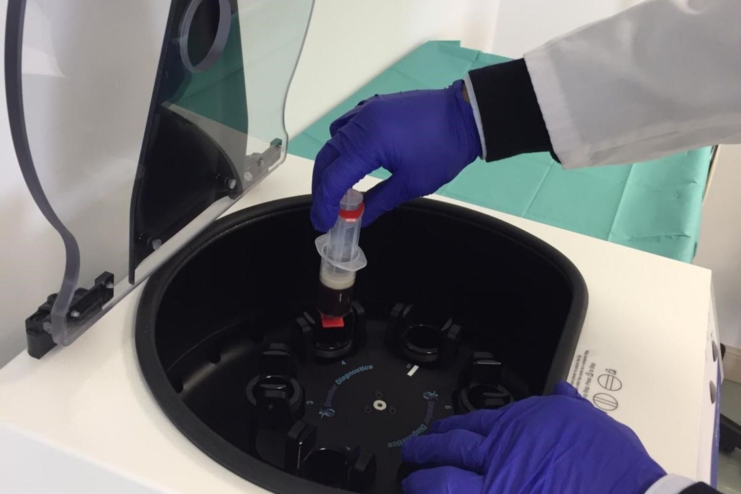 Pasma rico plaquetas 1