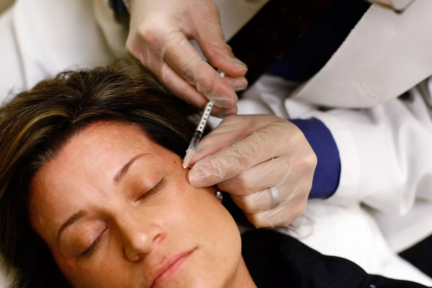 Una persona que se somete a un tratamiento de medicina estética / EP Una persona que se somete a un tratamiento de medicina estética / EP