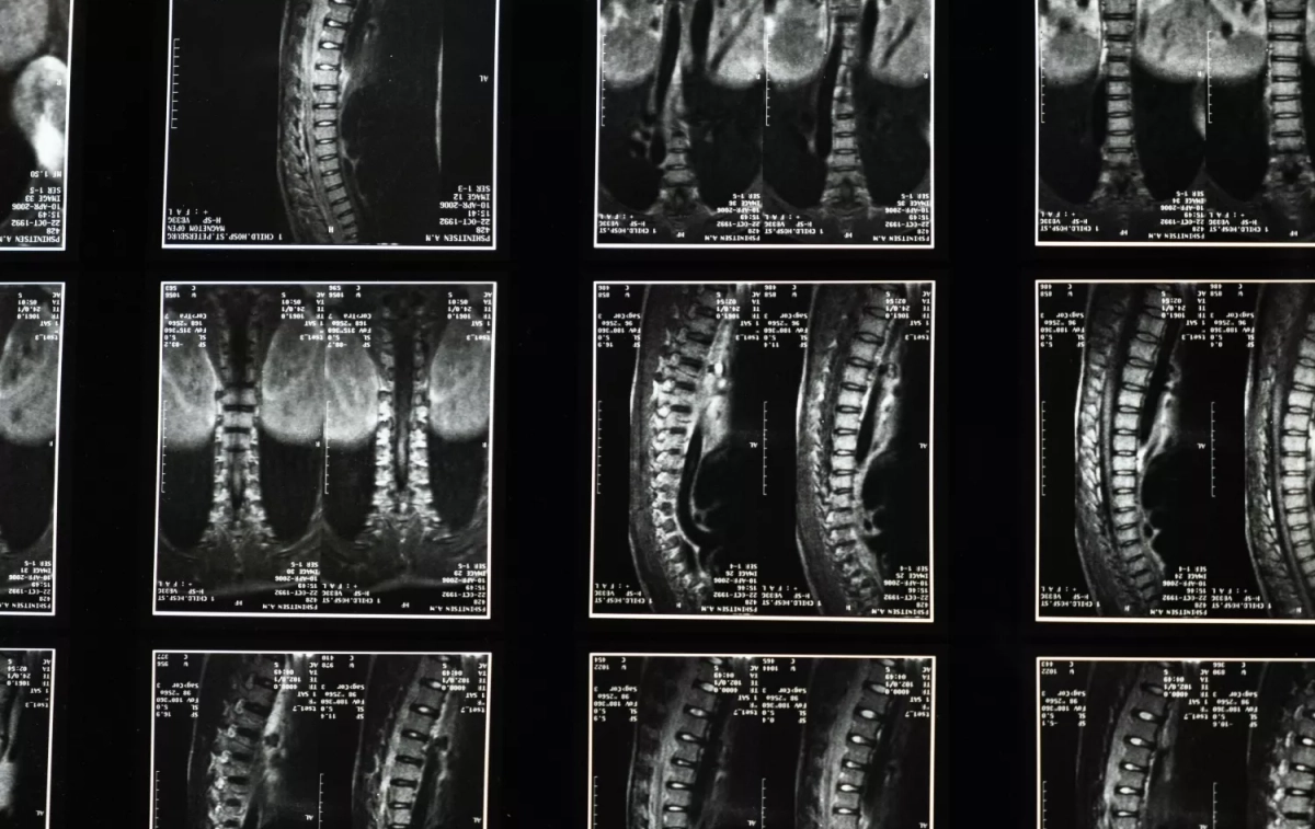 Una radiografía PEXELS Una radiografía PEXELS