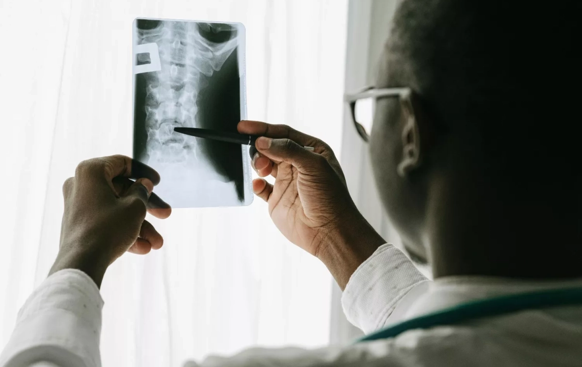 Un médico consulta una radiografía PEXELS Un médico consulta una radiografía PEXELS