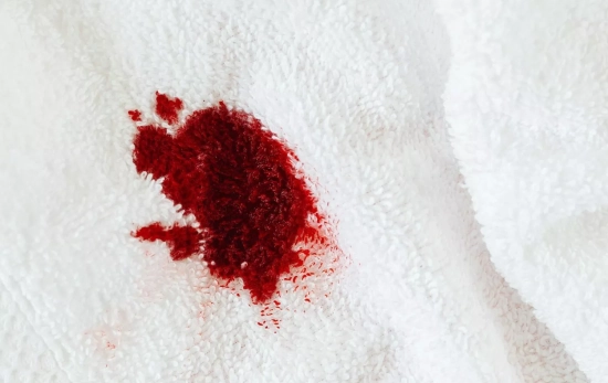 Cómo limpiar las manchas de sangre /PEXELS Cómo limpiar las manchas de sangre /PEXELS