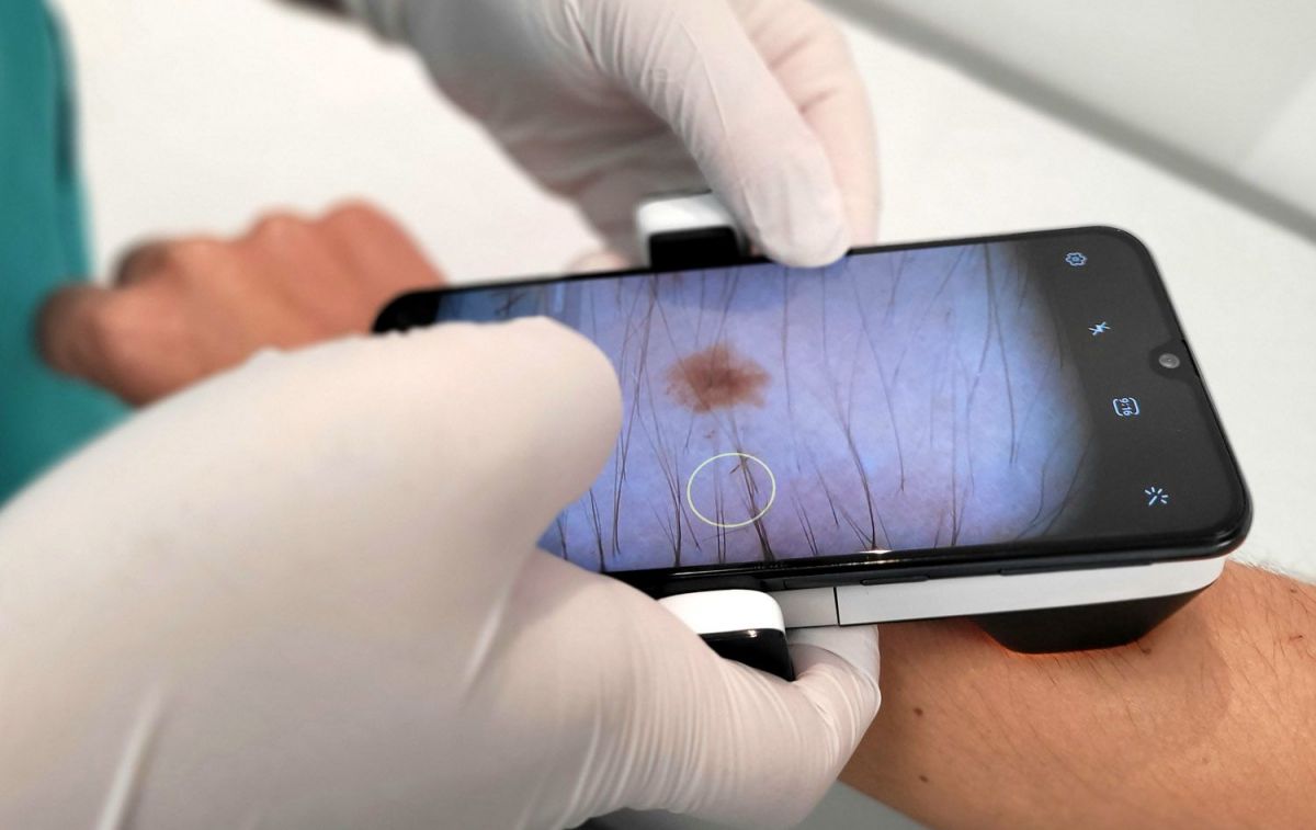 Un médico capta imágenes de la dermis de un paciente / QUIRÓNSALUD Un médico capta imágenes de la dermis de un paciente / QUIRÓNSALUD