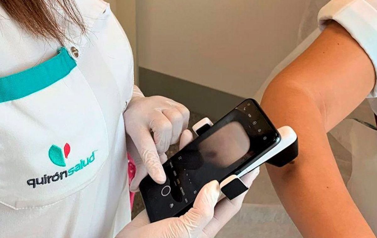 Un médico capta una imagen de una lesión cutánea / QUIRÓNSALUD Un médico capta una imagen de una lesión cutánea / QUIRÓNSALUD