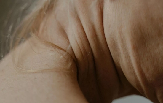 Es importante incidir en la piel del cuello, pues es la más frágil y tendente a perder elasticidad/ PEXELS Es importante incidir en la piel del cuello, pues es la más frágil y tendente a perder elasticidad/ PEXELS