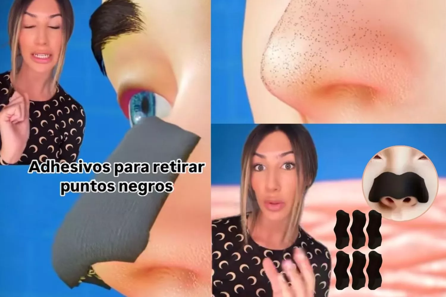 Tiritas anti puntos negros: Una doctora experta en 'skin care' revela si son tan buenas o dañinas/ Montaje CG