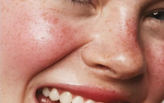 'Boyfriend Blush' la nueva tendencia viral de TikTok/ PINTEREST.COM 'Boyfriend Blush' la nueva tendencia viral de TikTok/ PINTEREST.COM