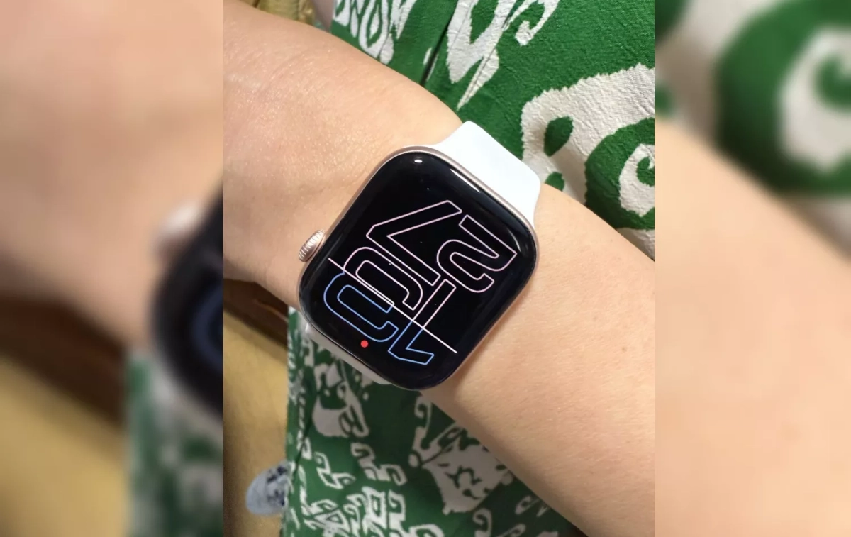 El Apple Watch Series 10 de Carles Castillejo CEDIDA El Apple Watch Series 10 de Carles Castillejo CEDIDA