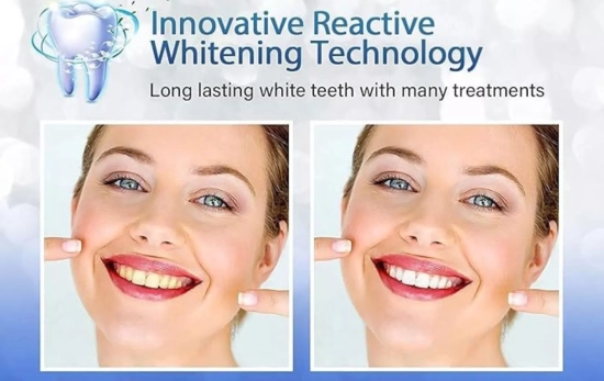 tiras blanqueadoras dientes blanqueador dental - Celakeety/ AMAZON tiras blanqueadoras dientes blanqueador dental - Celakeety/ AMAZON