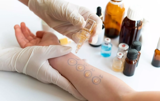 Una médico comprueba la reacción alérgica en el brazo de una persona / FREEPIK Una médico comprueba la reacción alérgica en el brazo de una persona / FREEPIK