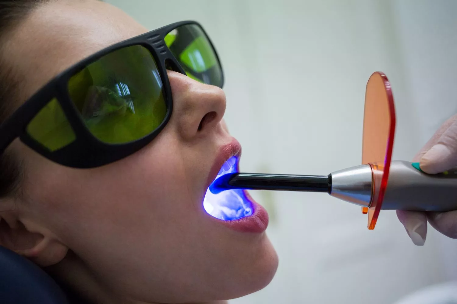 Una persona se somete a un tratamiento de blanqueamiento dental / FREEPIK - wavebreakmedia_micro