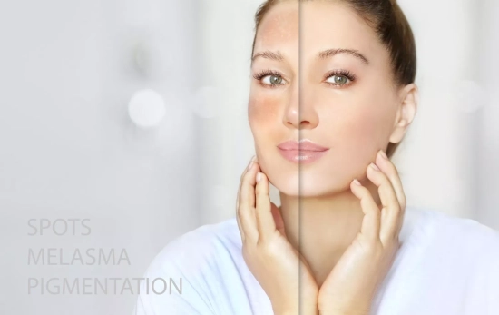Descubre cómo revitalizar tu piel: adiós manchas, acné, sequedad y arruguitas/ CANVA Descubre cómo revitalizar tu piel: adiós manchas, acné, sequedad y arruguitas/ CANVA