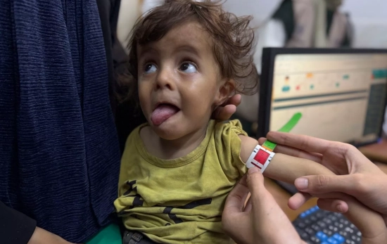 centro pediátrico que trata la desnutrición en el norte de la Franja, donde la hambruna se cobra ca centro pediátrico que trata la desnutrición en el norte de la Franja, donde la hambruna se cobra ca