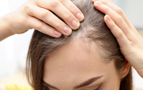 Una persona que se ha dado cuenta de la caída estacional en su cabello/ CANVA