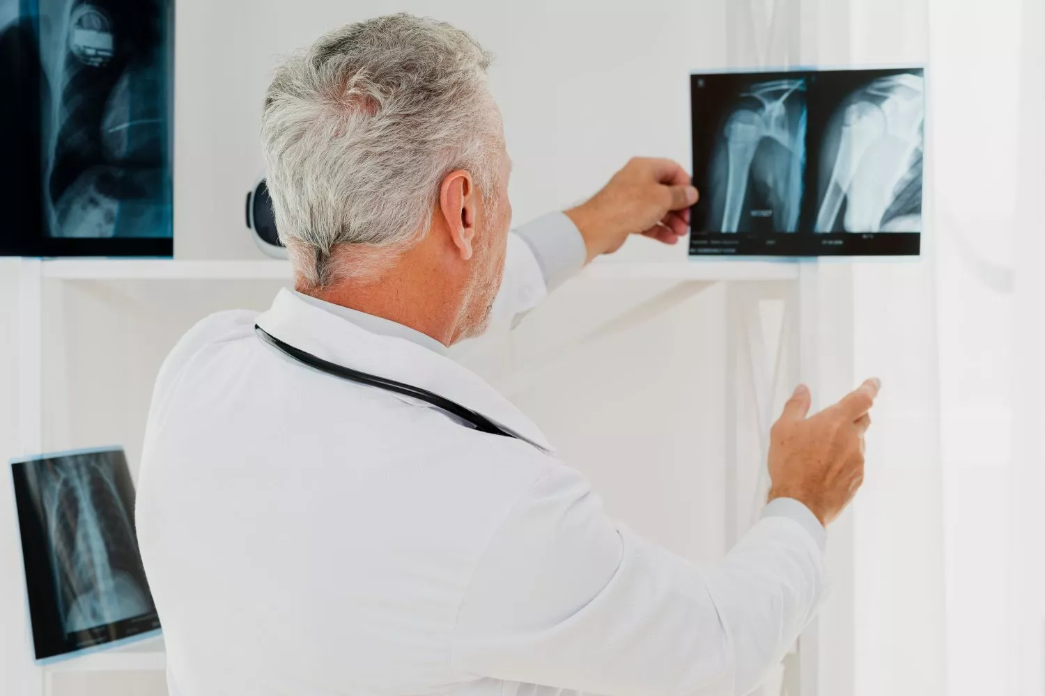 Un traumatólogo revisa la radiografía de un paciente / FREEPIK Un traumatólogo revisa la radiografía de un paciente / FREEPIK