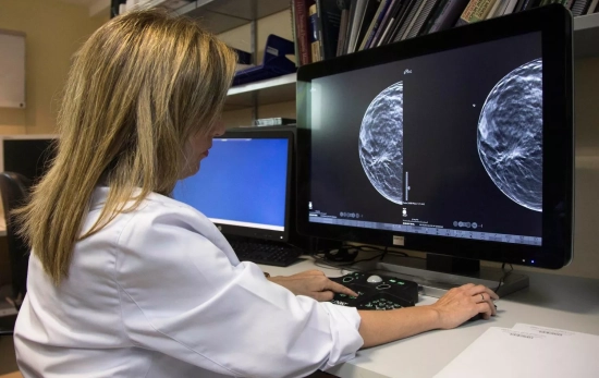 Una doctora muestra una mamografía / Miguel Angel Polo - EFE Una doctora muestra una mamografía / Miguel Angel Polo - EFE