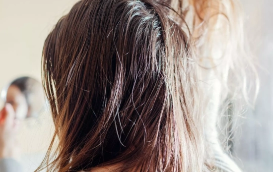 Una persona con el pelo sucio/ CANVA Una persona con el pelo sucio/ CANVA