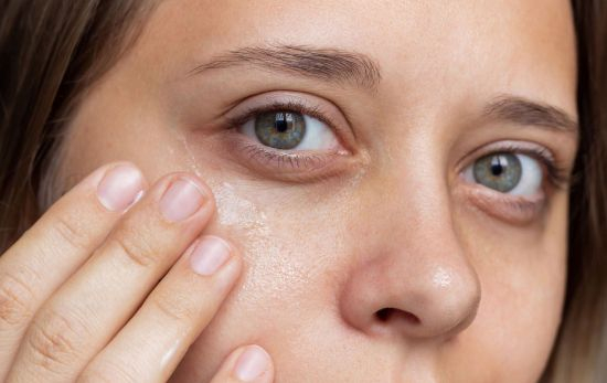 Una mujer combate sus ojeras con centella asiática / EP Una mujer combate sus ojeras con centella asiática / EP