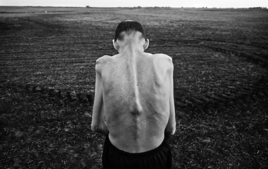 'El coste humano de las agrotoxinas' de Pablo E. Piovano / WORLD PRESS PHOTO 'El coste humano de las agrotoxinas' de Pablo E. Piovano / WORLD PRESS PHOTO