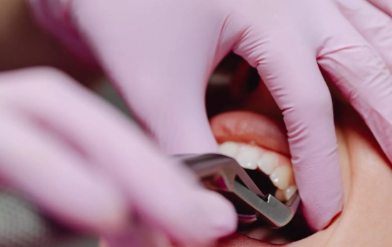 Un dentista trabajando Un dentista trabajando