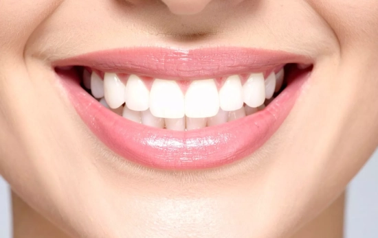 Una sonrisa blanca después de usar uno de los tratamientos blanqueadores/ CANVA Una sonrisa blanca después de usar uno de los tratamientos blanqueadores/ CANVA