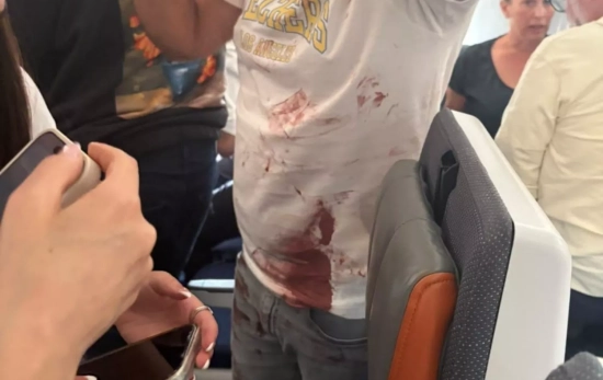 Un pasajero con manchas de sangre a bordo de un vuelo comercial de Flydubai/ Xinhua News - EP Un pasajero con manchas de sangre a bordo de un vuelo comercial de Flydubai/ Xinhua News - EP