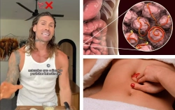 ¿Sufres de atracones, hinchazón o problemas intestinales? Qué alimentos comer para eliminar posibles parásitos de tu organismo