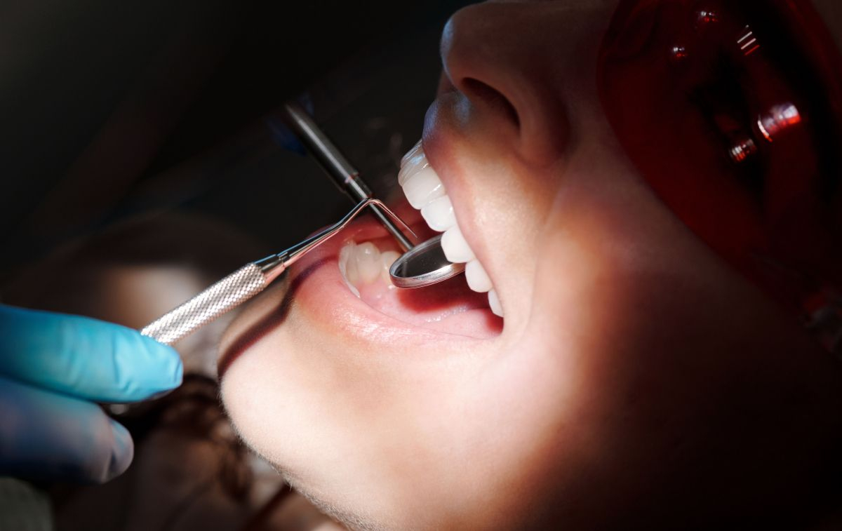 Una mujer durante un procedimiento en la consulta del dentista / PEXELS